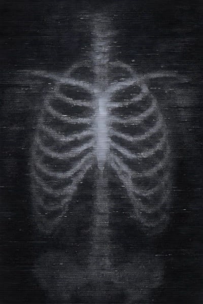 Xray